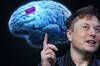 Elon Musk anuncia que Neuralink ha implantado por primera vez un chip cerebral en un humano