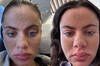 Los expertos en dermatologa advierten que la 'piel de caverncola' que arrasa en TikTok pone en riesgo la salud