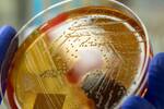 La 'bacteria come carne' pone en alerta a Espa�a: estos son los s�ntomas que pueden indicar un contagio en verano