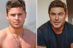 Zac Efron 'casi muere' tras el accidente que le deform� la cara