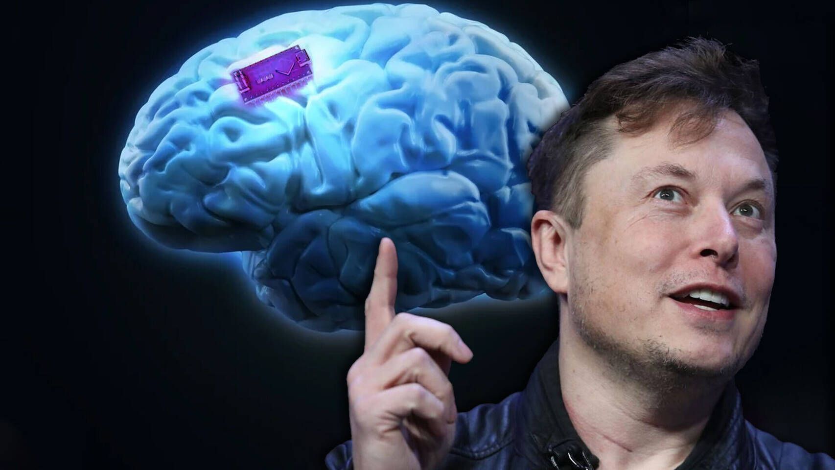 Elon Musk Anuncia Que Neuralink Ha Implantado Por Primera Vez Un Chip Cerebral En Un Humano 