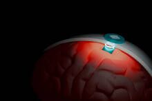 No es ciencia ficción, un minúsculo implante de 3 milímetros cúbicos y 65.000 electrodos le planta cara al Neuralink de Musk