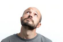 Hallazgo hist�rico de la ciencia: se revela el 'eslab�n perdido' que frena los fol�culos y crea la calvicie masculina