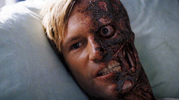 Harvey Dent