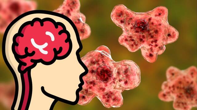 Fallece un hombre a causa de la infección de una ameba devoradora de cerebros