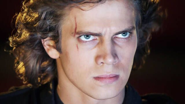 Cmo se hizo la cicatriz en la cara Anakin Skywalker? El canon de Star Wars todava no lo ha explicado