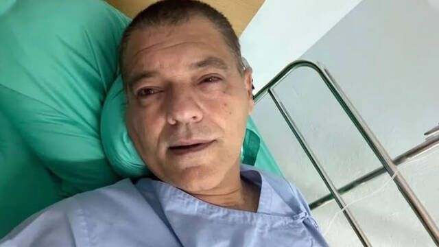 Esta es la cobra que atac a Frank Cuesta, escupe veneno a dos metros y puede causar ceguera