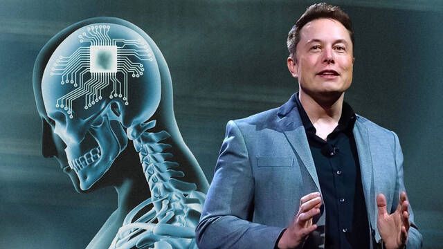 Neuralink podrá implantar chips en los cerebros de seres humanos: Elon Musk recibe luz verde