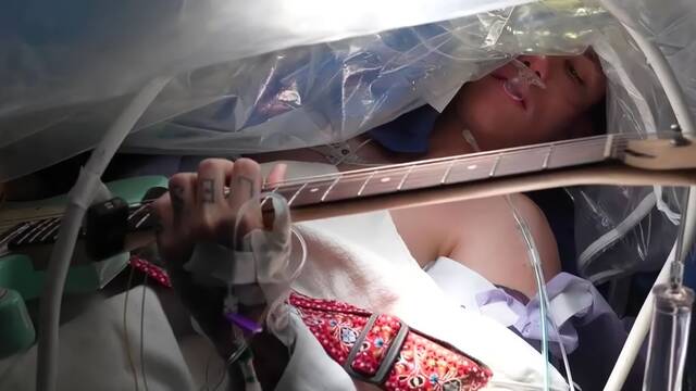 �Despierto en plena operaci�n de cerebro? La incre�ble t�cnica m�dica que parece ciencia ficci�n