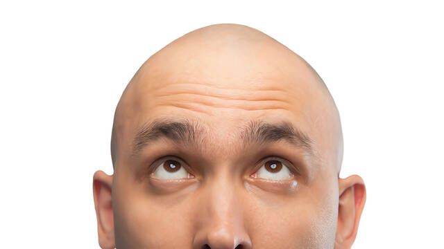 Adis a la calvicie: cientficos espaoles logran regenerar el pelo en ratones con una innovadora frmula
