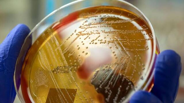La 'bacteria come carne' pone en alerta a Espa�a: estos son los s�ntomas que pueden indicar un contagio en verano